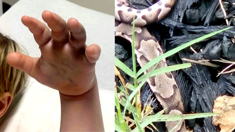 Parents in North Carolina say their child was bitten by a snake while at day care.