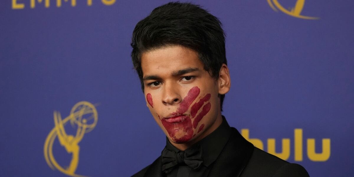 Tai Actor Ran Here’s why actor D’Pharaoh Woon-A-Tai had a red handprint on his face ...